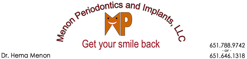 Dr. Hema Menon, Periodontist, Periodontics and Implants, Saint Paul, MN 55104 Dental Implants Gum Surgery